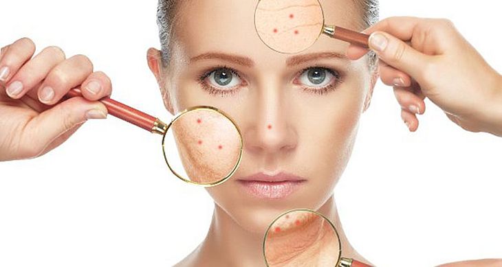 Mitos e Uso de Cosmecêuticos para Acne